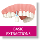 Basic Extractions