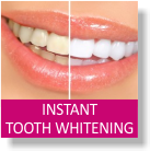 Instant Tooth Whitening