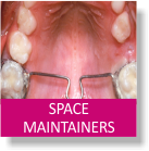 Space Maintainers